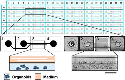 3D dynamic cultures of HGSOC organoids to model innovative and standard therapies